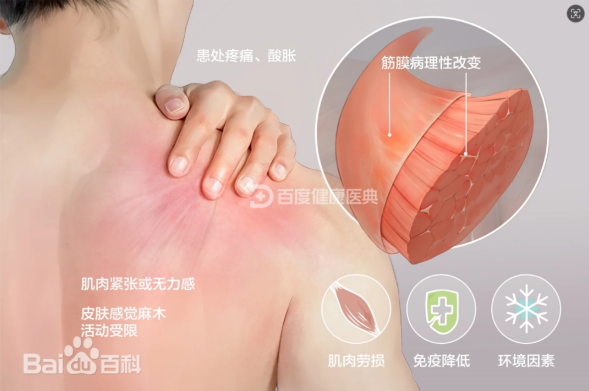 电磁式冲击波治疗仪
