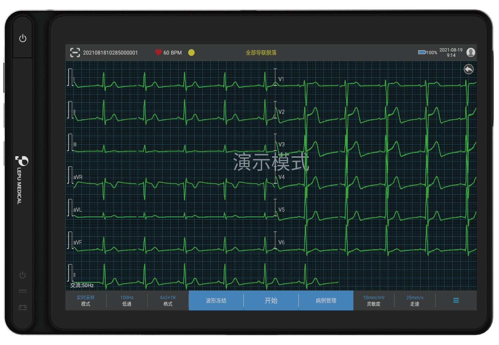 乐普AI便携式心电图机